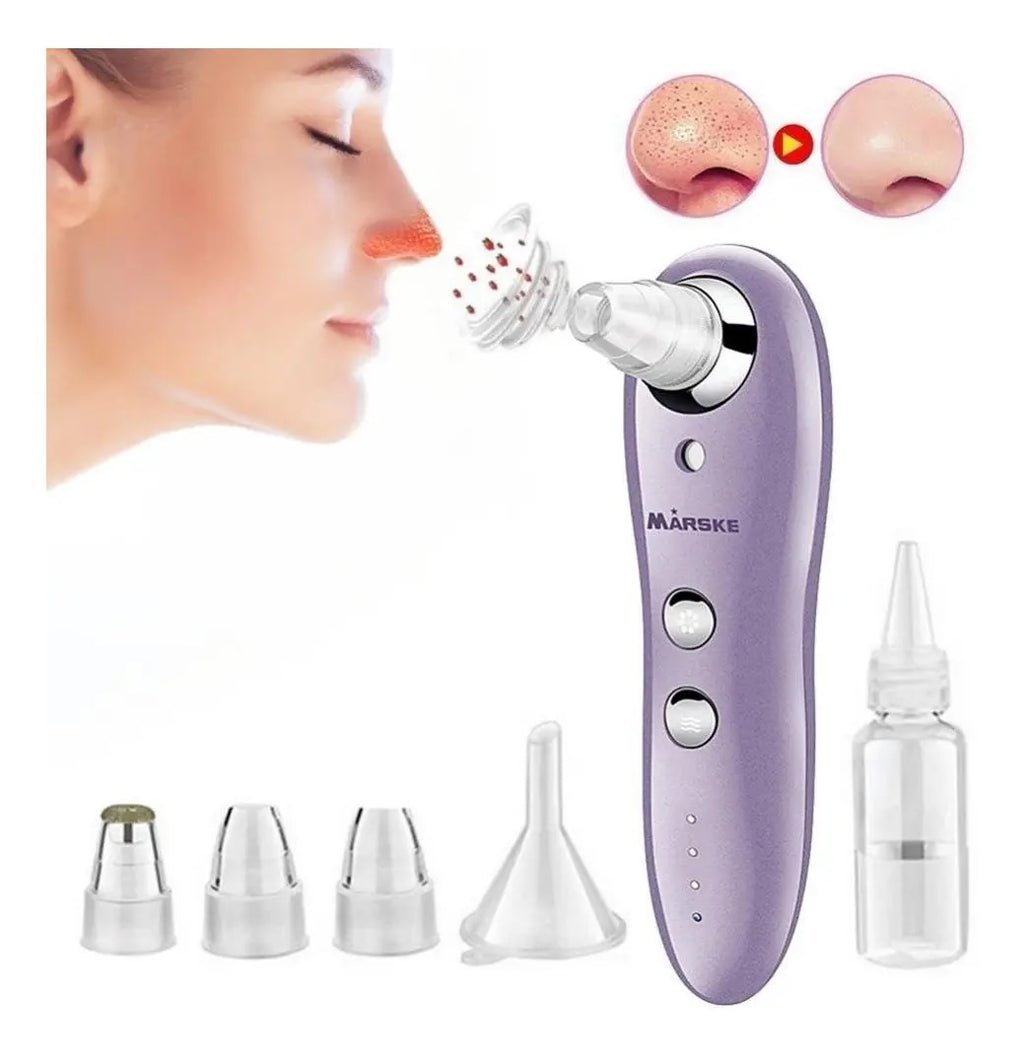 Limpiador Extractor Facial A Vapor Espin