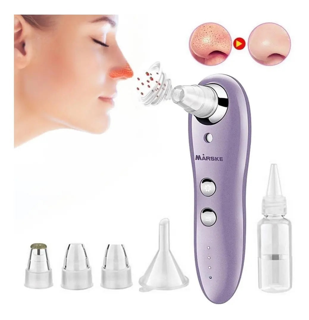Limpiador Extractor Facial A Vapor Espin